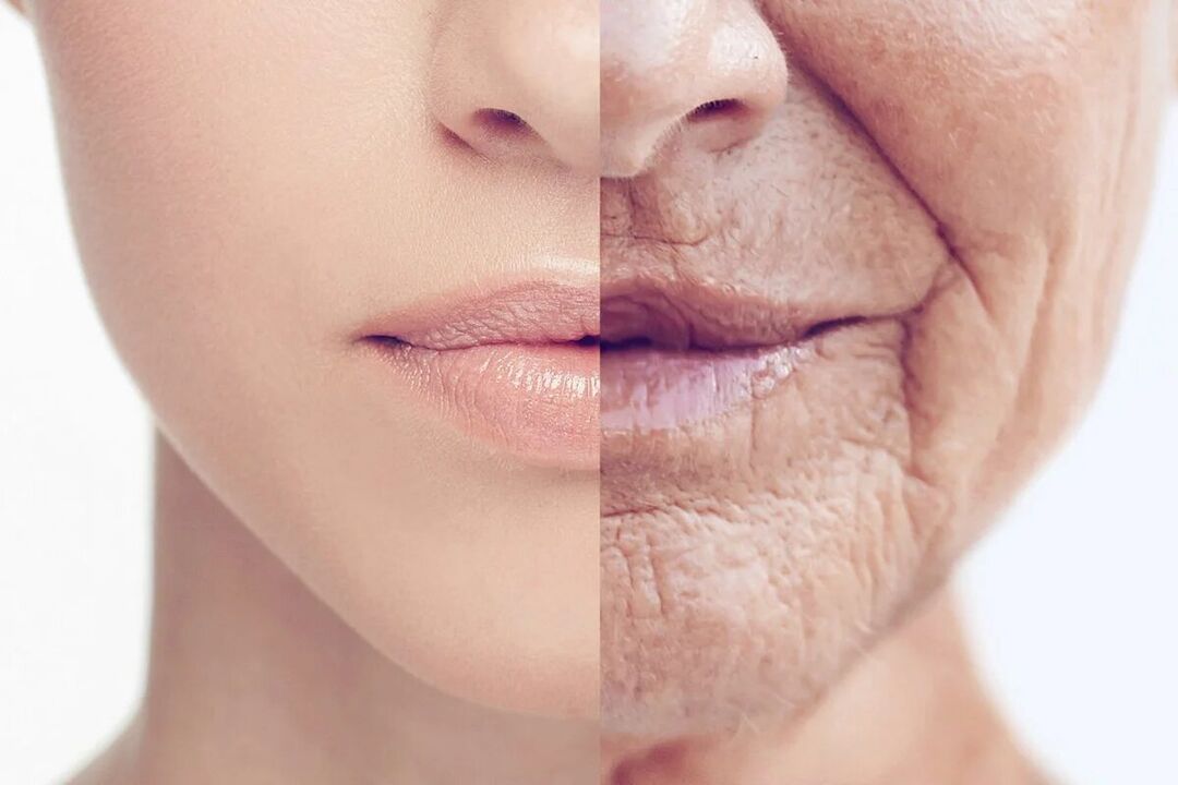 Deterioration of skin condition with age