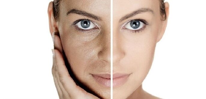 before and after skin rejuvenation