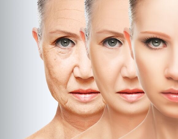 The process of getting rid of mimic wrinkles thanks to plasma rejuvenation